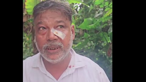 differently abled passenger assaulted on Island Express