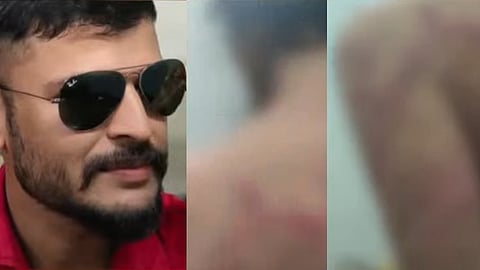 Ernakulam Yuva Morcha leader arrested in case of brutally assaulting partner.