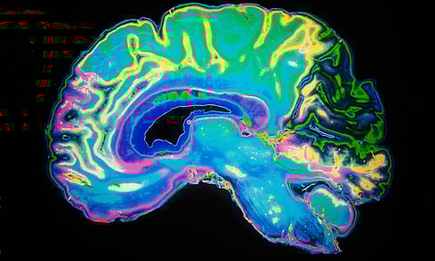 Image of Brain
