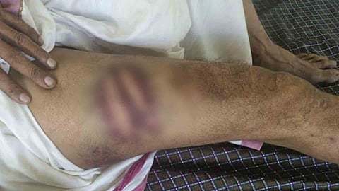 Auto driver alleges police assault in Thiruvananthapuram