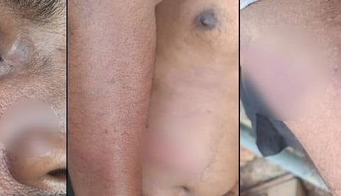 Thrissur police brutality:  wrongfully took a youth into custody and assaulted