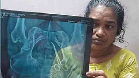 Medical negligence case