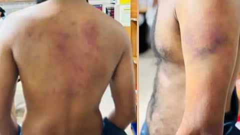 Disabled man brutally assaulted in Kochi after refusing sexual demands