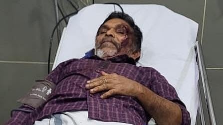 UDF booth agent hit on the head and hospitalized