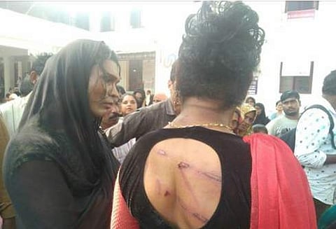 കോഴിക്കോട് ട്രാന്‍സ്‌ജെന്‍ഡേഴ്‌സിന് പൊലീസിന്റെ ക്രൂരമര്‍ദനം