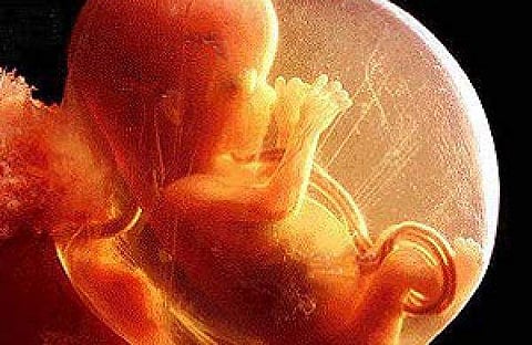 മഹാരാഷ്ട്രയില്‍ ഓവുചാലില്‍ പെണ്‍ഭ്രൂണങ്ങള്‍: ഡോക്ടര്‍ പിടിയില്‍