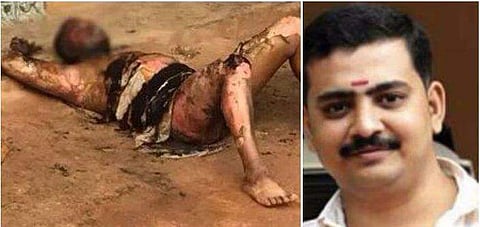 യുവമോര്‍ച്ച നേതാവ് പൊള്ളലേറ്റ് മരിച്ച സംഭവം; സംശയത്തിന്റെ നിഴലില്‍ അമ്പിളി, കാറില്‍ നിന്നും വലിച്ചിറക്കി കത്തിച്ചു