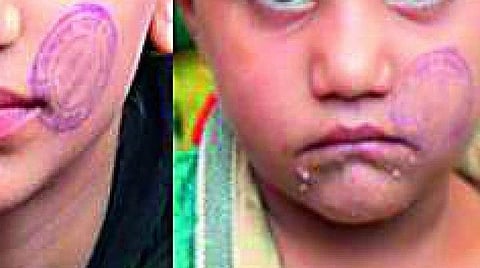 ഭോപ്പാല്‍ ജയിലില്‍ അച്ഛനെ കാണാനെത്തിയ കുഞ്ഞുങ്ങളുടെ മുഖത്ത് സീല്‍ പതിപ്പിച്ചു