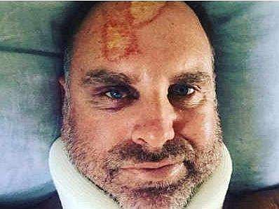 മാത്യൂ ഹെയ്ഡന് സര്‍ഫിങിനിടെ തലയ്ക്കും കഴുത്തിനും പരിക്ക്; തലനാരിഴയ്ക്ക് രക്ഷപ്പെട്ടതായി താരം 