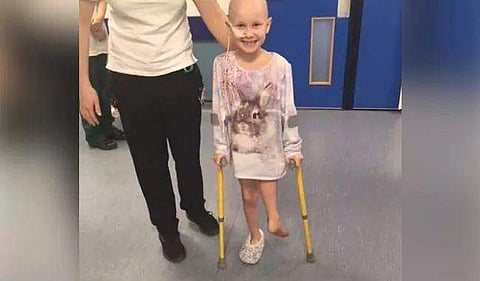 ഈ കുട്ടിയുടെ കാല്‍ എന്താ ഇങ്ങനെ? ഡോക്റ്റര്‍മാര്‍ക്ക് പറ്റിയ അബദ്ധമൊന്നുമല്ല, കാല്‍ തിരിഞ്ഞുപോകാനുള്ള കാരണം മറ്റൊന്നാണ്