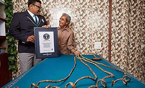 വിശ്വ വിഖ്യാതമായ നഖം മുറിക്കാന്‍ തീരുമാനിച്ച് ശ്രീധര്‍ ചില്ലാല്‍ ;  66 വര്‍ഷം പ്രായമുള്ള നഖം ഇനി യുഎസ് മ്യൂസിയത്തില്‍ 