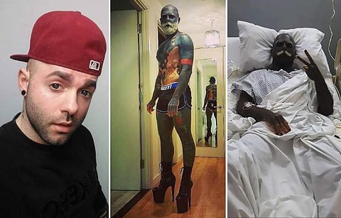 പച്ചകുത്താന്‍ തടസം; ലിംഗം മുറിച്ചുമാറ്റി യുവാവ്‌