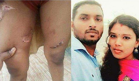 രണ്ടാനമ്മയുടെ ക്രൂരത പുറത്തെത്തിച്ചതിന് അഭിനന്ദിക്കുകയായിരുന്നു വേണ്ടത്; അധ്യാപികയെ പുറത്താക്കിയത് അംഗീകരിക്കാനാകില്ല: പിണറായി 