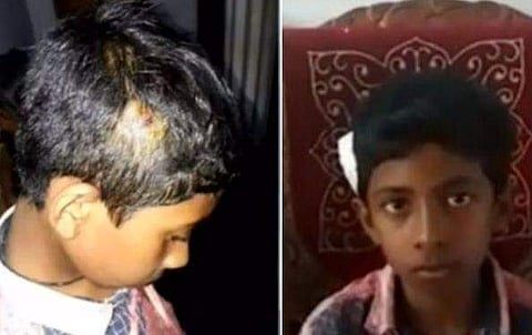 ക്ലാസില്‍ സംസാരിച്ചതിന് അഞ്ചാം ക്ലാസുകാരനെ മൊബൈല്‍ കൊണ്ട് തലയ്ക്കടിച്ചു; പ്രധാന അധ്യാപികയ്ക്ക് സസ്‌പെന്‍ഷന്‍