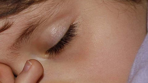 പ്രതീകാത്മക ചിത്രം