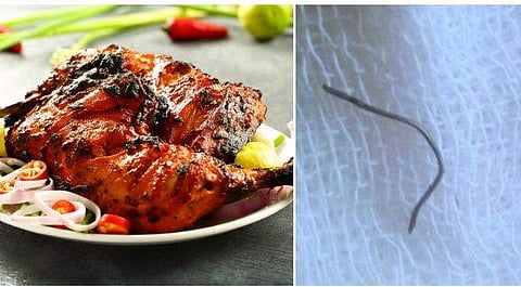 'ചിക്കന്‍ ഫ്രൈ മാത്രമല്ല ഏതൊരു ഭക്ഷണവും അപകടകാരിയാകാം ; അശ്രദ്ധ, ജീവിതം കൊണ്ടുള്ള ഭാഗ്യപരീക്ഷണം' ; ഡോക്ടറുടെ വിശദീകരണക്കുറിപ്പ്