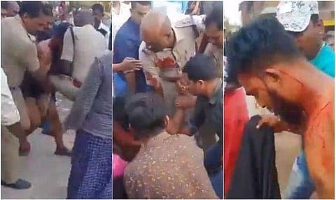 ബിയർ കുപ്പി പൊട്ടിച്ച് എസ്ഐയെ കുത്തി പ്രതി; സംഭവം ‌ഭിന്നശേഷിക്കാരിയെ പീഡിപ്പിക്കാൻ ശ്രമിച്ച കേസിൽ പിടികൂടാനെത്തിയപ്പോൾ, വിഡിയോ