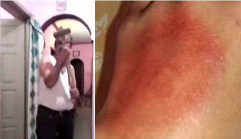 സിനിമ ഡയലോ​ഗ് പറഞ്ഞ് പത്തുവയസ്സുകാരിയെ ചുറ്റിക കൊണ്ട് അടിച്ചു ; അച്ഛൻ അറസ്റ്റിൽ