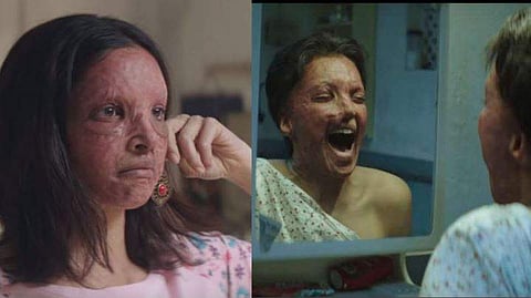 കണ്ണാടിയിലെ മുഖം കണ്ട് അലറിക്കരഞ്ഞ് ദീപിക; പോരാട്ടത്തിന്റെ കഥ പറഞ്ഞ് 'ചപ്പാക്ക്'; ട്രെയിലര്‍ പുറത്ത്