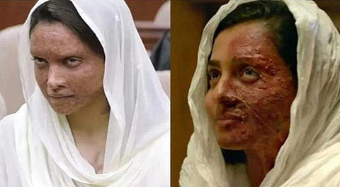 ഛപാക്കിന് പാര്‍വതിയുടെ ഉയരെയുമായി സാമ്യം?; മറുപടിയുമായി ദീപിക പദുക്കോണ്‍