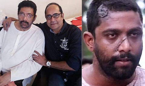 'കീരിക്കാടന് ആരുടേയും സാമ്പത്തിക സഹായം ആവശ്യമില്ല'; മോഹന്‍രാജിനെ ആശുപത്രിയിലെത്തി സന്ദര്‍ശിച്ച് ദിനേശ് പണിക്കര്‍