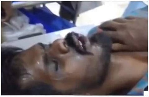 വാളയാര്‍ പീഡനക്കേസില്‍ കോടതി വിട്ടയച്ച പ്രതിയെ നാട്ടുകാര്‍ കയ്യേറ്റം ചെയ്തു; അവശനായി വഴിയരികില്‍, പൊലീസ് ആശുപത്രിയിലാക്കി