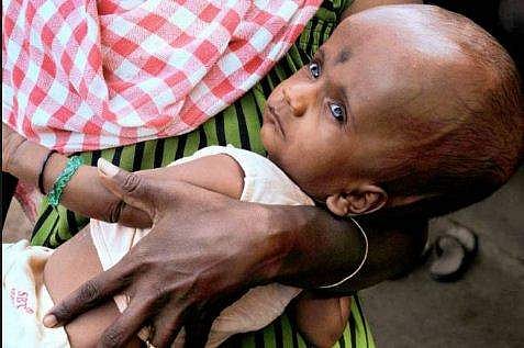 എന്‍ഡോസള്‍ഫാന്‍ ; സമരം അവസാനിപ്പിക്കില്ല, ഞായറാഴ്ച  ക്ലിഫ്ഹൗസിലേക്ക് സങ്കടയാത്രയെന്ന് സമരസമിതി