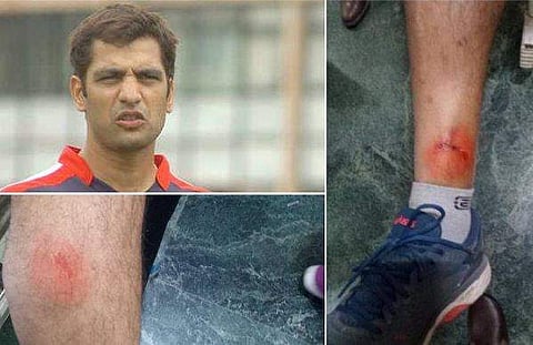 ടീമിലേക്ക് തിരഞ്ഞെടുത്തില്ല; മുൻ ഇന്ത്യൻ താരത്തെ യുവ താരവും ​ഗുണ്ടകളും അക്രമിച്ചു