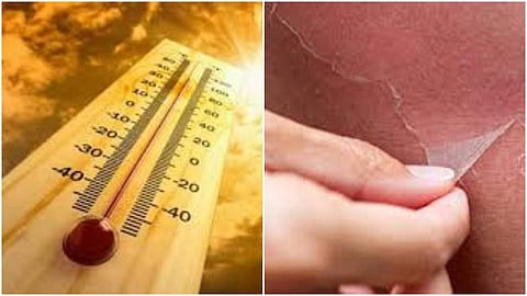 നാളെയും മറ്റന്നാളും താപനില നാല് ഡി​ഗ്രിവരെ ഉയരാം; അഞ്ച് ജില്ലകൾക്ക് മുന്നറിയിപ്പ്; മാര്‍ച്ചില്‍ സൂര്യാഘാതമേറ്റത് 118 പേര്‍ക്ക് 