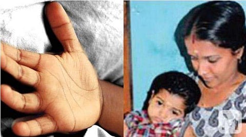 മെഡിക്കൽ കോളേജ് ഐസിയുവിലെ പട്ടികയിൽ ഇനി സച്ചുവിൻ്റെ പേരില്ല; ഏഴു വർഷം വെൻ്റിലേറ്ററിൽ കഴിഞ്ഞ കുട്ടി വിടവാങ്ങി 