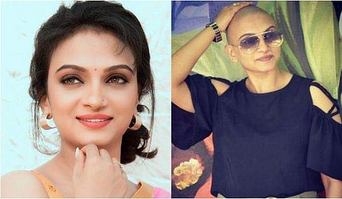 മേക്കപ്പല്ല ശരിക്കും മൊട്ടയാണ്! കൃഷ്ണപ്രഭയെകണ്ട് ഞെട്ടി ആരാധകര്‍; കാരണമിതാണ്  