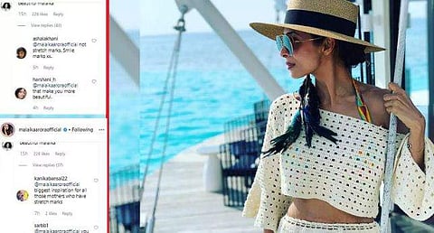 വയറിലെ സ്ട്രച്ച്മാര്‍ക്കുകള്‍ മറയ്ക്കാതെ മലൈയ്ക: ഫോട്ടോ വൈറല്‍