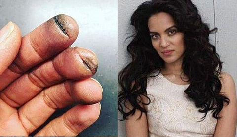 'നിങ്ങൾ വിഷമിക്കല്ലേ... ഈ മുറിവുകൾ എനിക്കൊരു വേദനയല്ല'; മനസ് തുറന്ന് അനൗഷ്ക