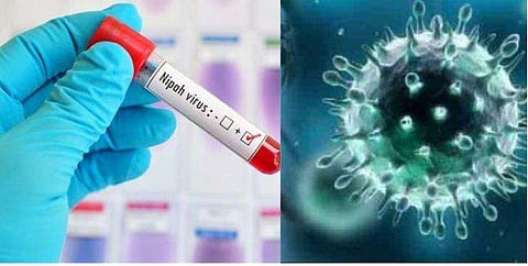 നിപ സംശയം: ഫലം ഇന്നറിയാം; ആരോഗ്യമന്ത്രിയുടെ വാര്‍ത്താസമ്മേളനം രാവിലെ ഒമ്പതരയോടെ