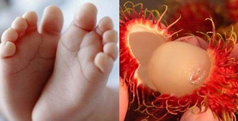 റമ്പൂട്ടാന്റെ കുരു തൊണ്ടയില്‍ കുരുങ്ങി പിഞ്ചുകുഞ്ഞിന് ദാരുണാന്ത്യം