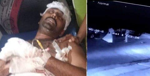 പിന്തുടര്‍ന്ന് വെട്ടിവീഴ്ത്തി ; ശരീരത്തില്‍ ബൈക്ക് ഓടിച്ചുകയറ്റി ; സിഒടി നസീറിനെ ആക്രമിക്കുന്ന സിസിടിവി ദൃശ്യങ്ങള്‍ പുറത്ത്