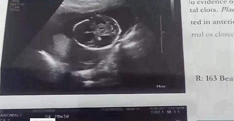 സ്വകാര്യലാബിലെ പരിശോധന പിഴവ്;  ഗര്‍ഭസ്ഥ ശിശുക്കള്‍ മരിച്ചു; പ്രതിഷേധം