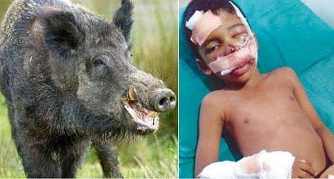 കാട്ടുപന്നി ചാടിവീണ് ഓട്ടോ മറിഞ്ഞു ; യാത്രക്കാരനായ ബാലന്റെ മുഖം പന്നി കടിച്ചുകീറി ; 65 തുന്നൽ