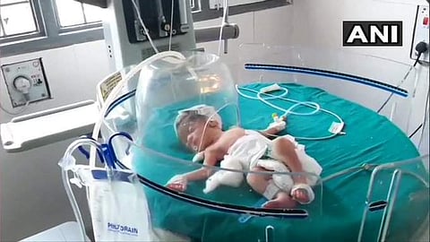 നെഞ്ചുപിളര്‍ക്കുന്ന ക്രൂരത!; നവജാതശിശുവിനെ സ്ത്രീ ഓവുചാലിലേക്ക് വലിച്ചെറിഞ്ഞു, രക്ഷയ്ക്ക് എത്തി തെരുവുപട്ടികള്‍; നടുക്കുന്ന കഥ 