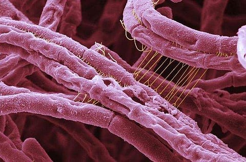 എന്താണ് ആന്ത്രാക്‌സ് ? ; രോഗലക്ഷണങ്ങള്‍ ഇവയെല്ലാം