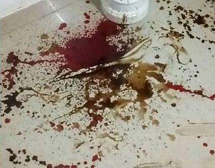 കുവൈറ്റില്‍ നിന്നും കൃത്യം നടത്താന്‍ പ്രതിയെത്തി ; ആസിഡ് ആക്രമണശേഷം സുഭാഷ് വിദേശത്തേക്ക് മുങ്ങി ?