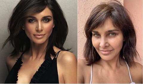 '47കാരിയായ ഞാന്‍ ഇങ്ങനെയാണ്'; കണ്‍തടത്തില്‍ കറുപ്പും ശരീരത്തില്‍ ചുളിവുകളുമുള്ള ചിത്രം പങ്കുവെച്ച് നടി; ഏറ്റെടുത്ത് സോഷ്യല്‍ മീഡിയ