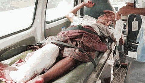 ഇതരസമുദായക്കാരുടെ വീട്ടില്‍ പോയി ഭക്ഷണം കഴിച്ചു; സഹോദരപുത്രന്‍ 68കാരന്റെ കാല്‍ വെട്ടിമാറ്റി