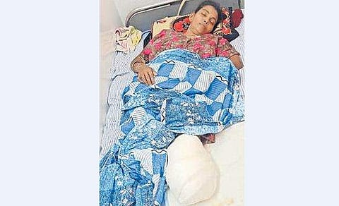 ഇറങ്ങുന്നതിനിടെ മുന്നോട്ടെടുത്ത ബസിൽ നിന്നു വീണു; വീട്ടമ്മയുടെ കാൽ മുറിച്ചു മാറ്റി