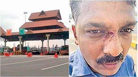 ടോള്‍ പ്ലാസയില്‍ ട്രാക്ക് തെറ്റിച്ചു കയറി, ദമ്പതികളെ കയ്യേറ്റം ചെയ്തു, അസഭ്യവര്‍ഷം; ഫോണ്‍ എറിഞ്ഞ് തകര്‍ത്തു