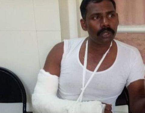 ബീഡി വാങ്ങി നല്‍കിയില്ല; പ്രതി പൊലീസുകാരന്റെ കൈ തല്ലിയൊടിച്ചു