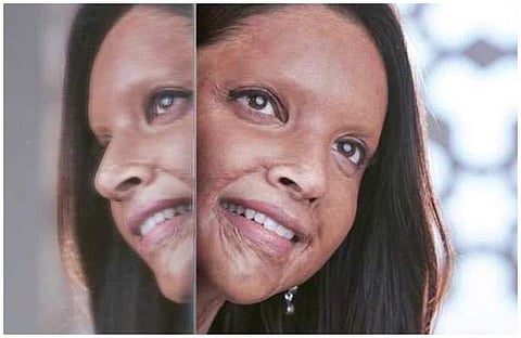 സിനിമ ബഹിഷ്‌കരിക്കാന്‍ ബിജെപിയുടെ ആഹ്വാനം: യുപിയില്‍ ഛപാക്കിന്റെ പ്രത്യേക പ്രദര്‍ശനം; ഒരു സംസ്ഥാനം കൂടി വിനോദ നികുതി ഒഴിവാക്കി