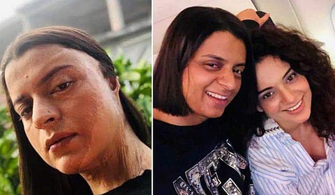 'അയാള്‍ എന്റെ സുഹൃത്തായിരുന്നു'; ആസിഡ് ആക്രമണം നടത്തിയ ആളുടെ പേര് വെളിപ്പെടുത്തി രംഗോലി