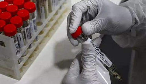 ആർടിപിസിആർ പരിശോധന കൂട്ടണം, കോവിഡ് പോസിറ്റിവിറ്റി നിരക്ക് 5 ശതമാനത്തിൽ താഴെയാക്കണം; കേരളം ഉൾപ്പെടെ  10 സംസ്ഥാനങ്ങളോട് കേന്ദ്രം