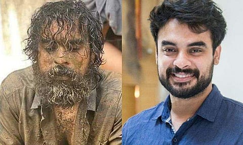 ആന്തരിക രക്തസ്രാവം രക്തക്കുഴൽ മുറിഞ്ഞതിനാൽ, ആൻജിയോ​ഗ്രാം ടെസ്റ്റ് നടത്തും; ടൊവിനോയ്ക്ക് മൂന്നാഴ്ച വിശ്രമം